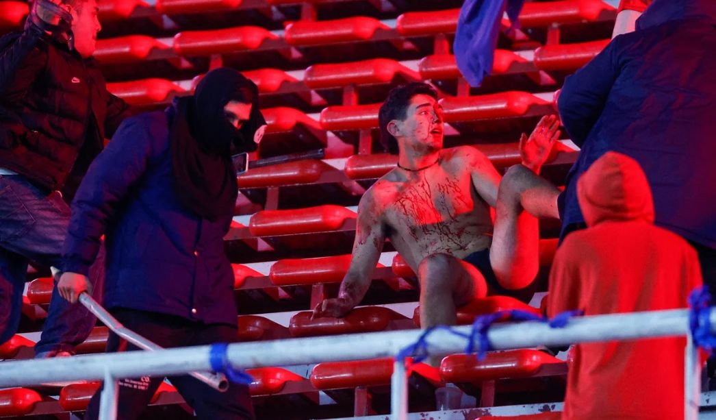 El ataque a un hincha de la U de Chile
