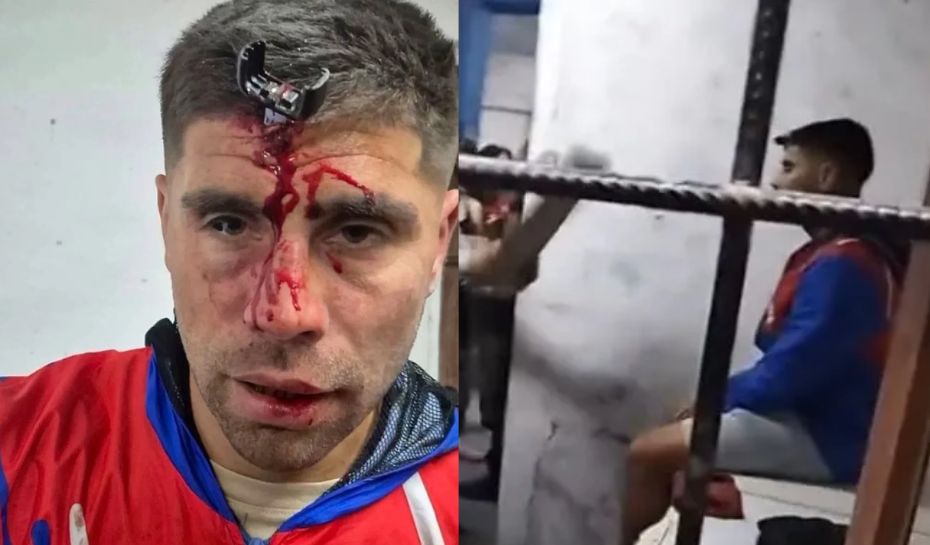 Le clavaron una llave en la frente al jugador del ascenso Junathan Smith