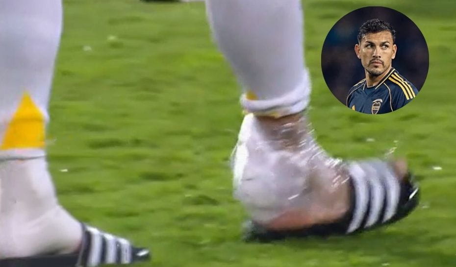 Paredes se retiró con hielo en el tobillo derecho